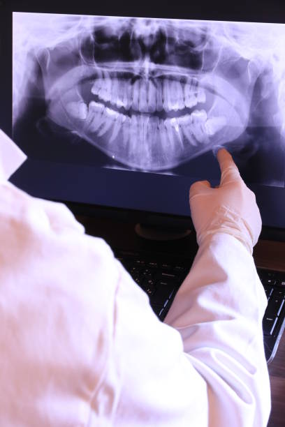 Best Emergency Dental Care for Broken or Chipped Teeth in Sigourney, IA