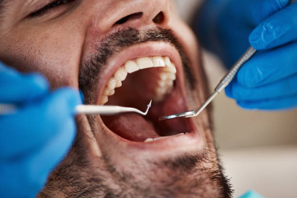 Best Urgent Care for Lost Fillings or Crowns in Sigourney, IA